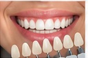 Cosmetic Dentistry