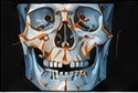 Maxillofacial Trauma