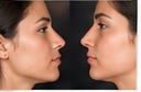 Orthognathic Surgery