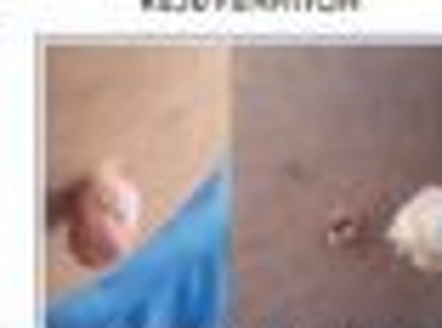 Skin Tag Removal